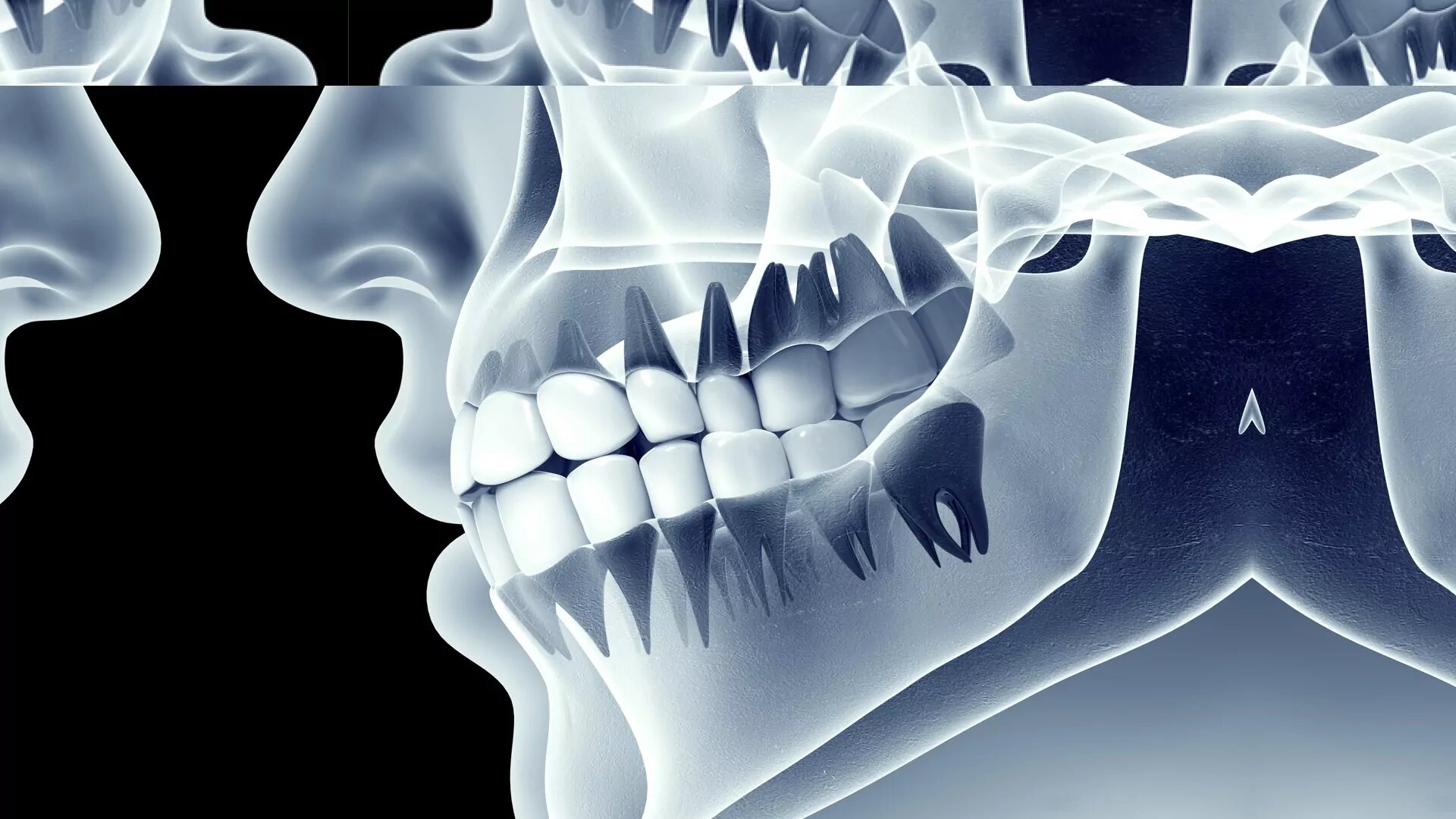 Craniomandibuläre Dysfunktion Zahnarzt in Düsseldorf